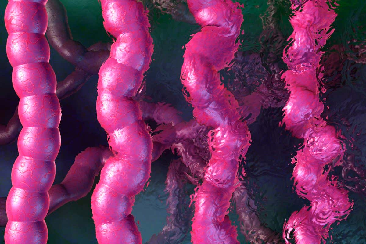 Computer artwork showing how irritable bowel syndrome affects the digestive tract